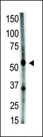 Rabbit Polyclonal Antibody to GDF5 (N-term)