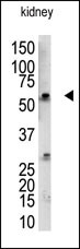 Rabbit Polyclonal Antibody to RBCK1 (UBCE7IP3) (N-term)