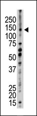 Rabbit Polyclonal Antibody to UBE4B (N-term)