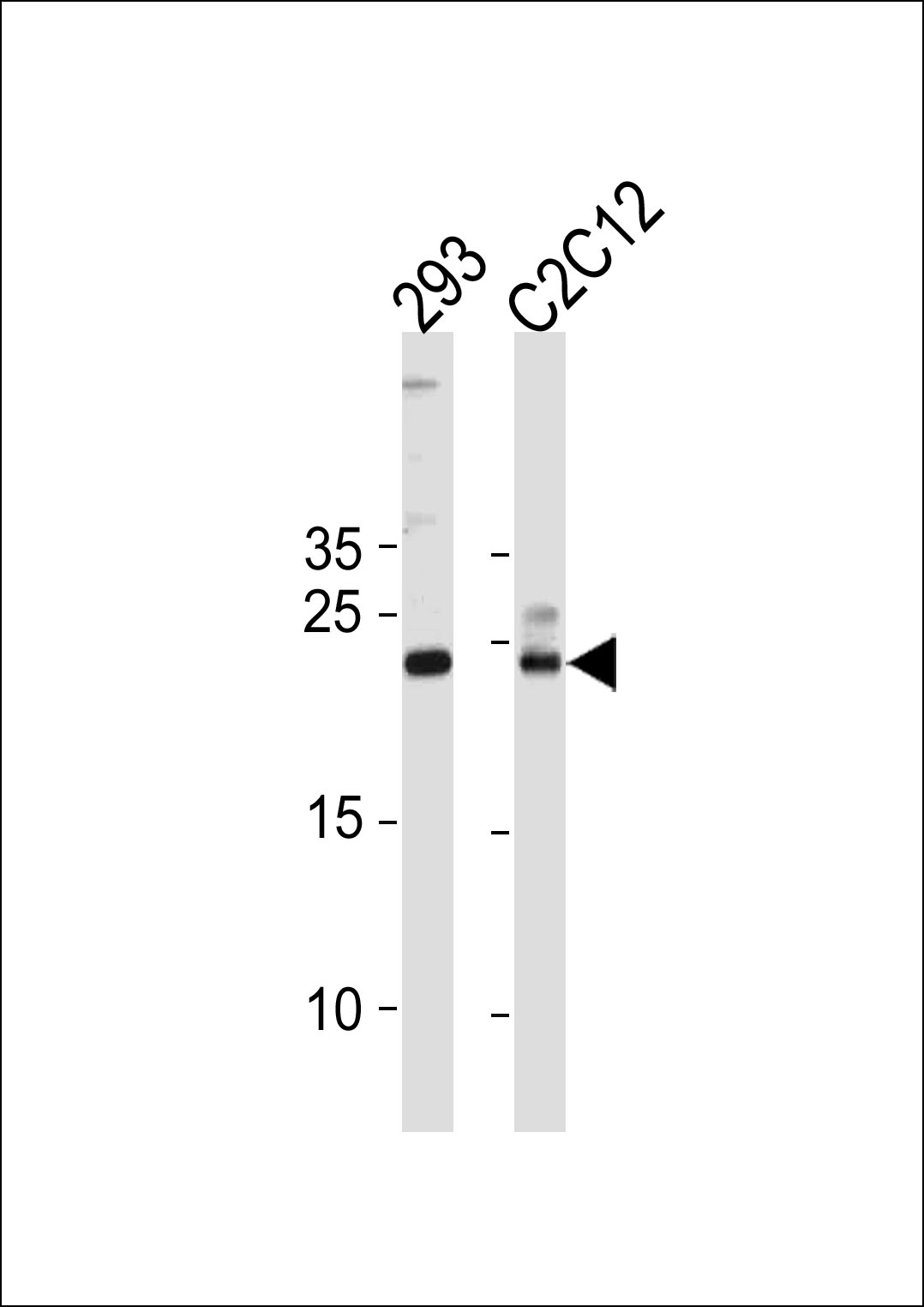 Rabbit Polyclonal Antibody to HIP2
