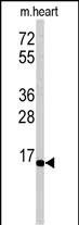 Rabbit Polyclonal Antibody to UBE2G1 (N-term)