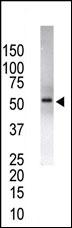 Rabbit Polyclonal Antibody to USP14 (N-term)