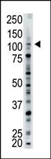 Rabbit Polyclonal Antibody to USP15 (N-term)