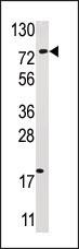 Rabbit Polyclonal Antibody to USP16