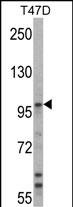 Rabbit Polyclonal Antibody to UBE3A