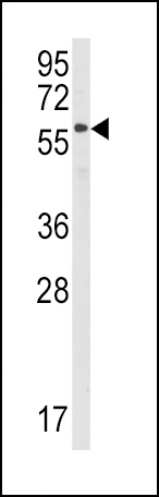 Rabbit Polyclonal Antibody to STAM