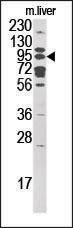 Rabbit Polyclonal Antibody to GCS1