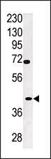 Rabbit Polyclonal Antibody to TPST2