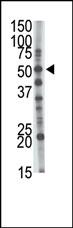 Rabbit Polyclonal Antibody to GCNT1