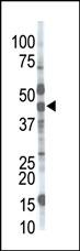 Rabbit Polyclonal Antibody to MGAT1 (N-term)