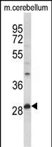 Rabbit Polyclonal Antibody to PPT1 (N-term)