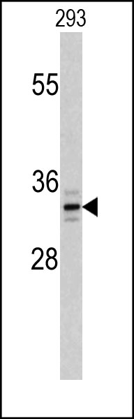 Rabbit Polyclonal Antibody to PPT1