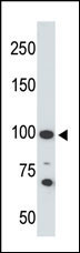 Rabbit Polyclonal Antibody to ACE2 (SARS Receptor)