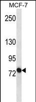 Rabbit Polyclonal Antibody to ABCB10 (N-term)
