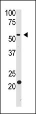 Rabbit Polyclonal Antibody to BACE2