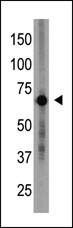 Rabbit Polyclonal Antibody to Cry1