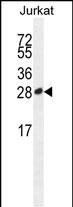 Rabbit Polyclonal Antibody to ICOS