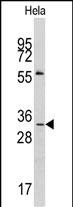 Rabbit Polyclonal Antibody to MAGEA1