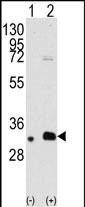 Rabbit Polyclonal Antibody to MAGEB2 (N-term)