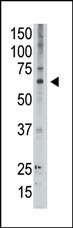 Rabbit Polyclonal Antibody to MAGED2