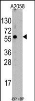 Rabbit Polyclonal Antibody to HSC70 Interacting Protein HIP (ST13)