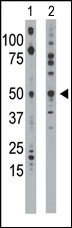 Rabbit Polyclonal Antibody to Ethanolamine Kinase (EKI1) (N-term)