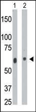 Rabbit Polyclonal Antibody to CERK