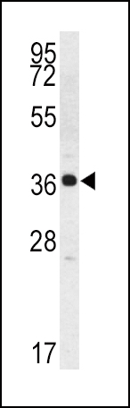 Rabbit Polyclonal Antibody to Kallikrein 2 (KLK2)