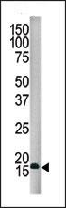 Rabbit Polyclonal Antibody to SUMO4
