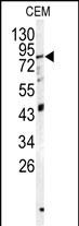 Rabbit Polyclonal Antibody to PAPSS1 (N-term K9)