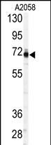 Rabbit Polyclonal Antibody to PAPSS1 (C-term A607)
