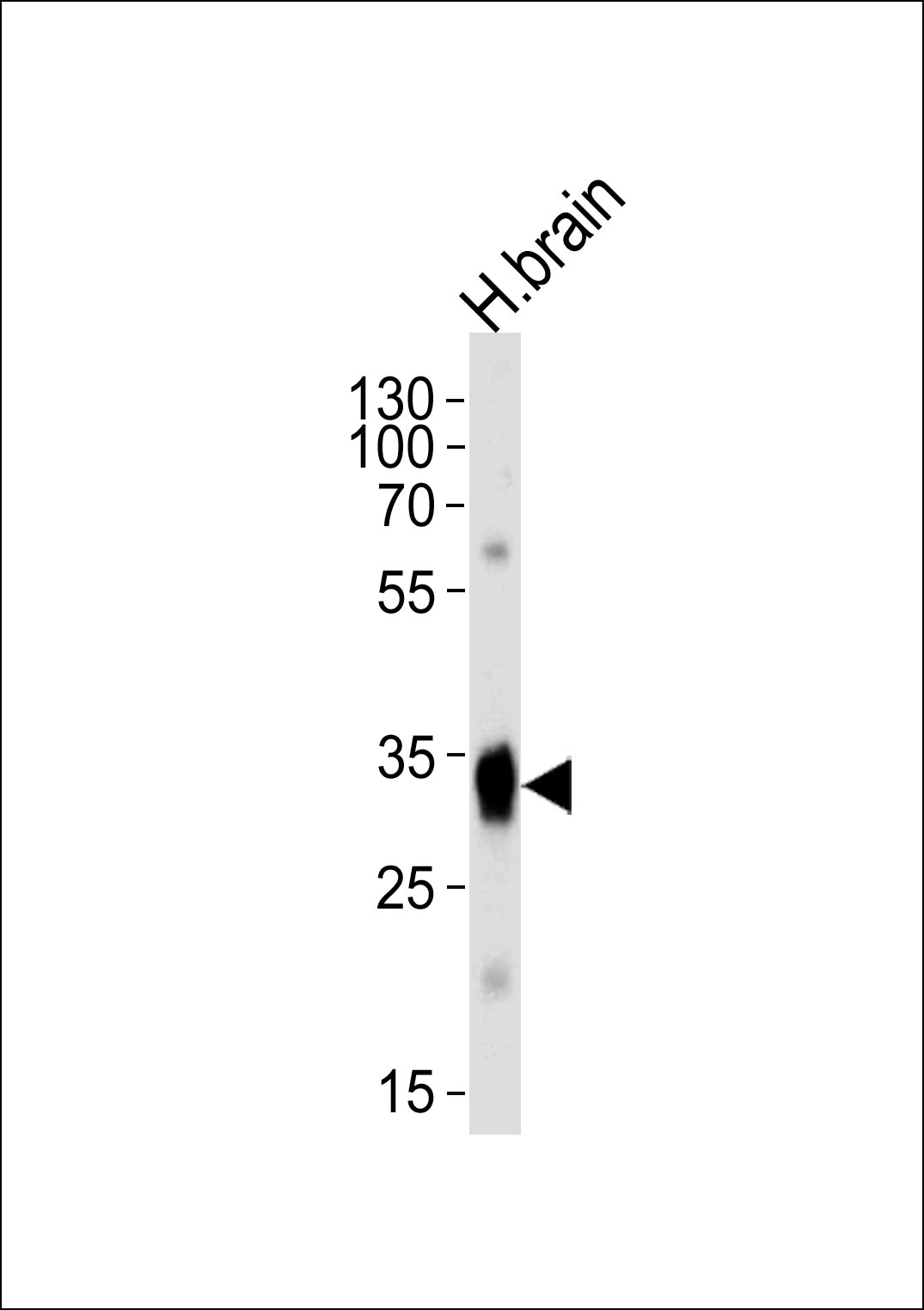 Rabbit Polyclonal Antibody to SULT4A1a/b (N-term)
