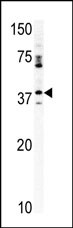Rabbit Polyclonal Antibody to CCRK (N-term)