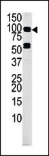Rabbit Polyclonal Antibody to MARK4