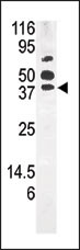 Rabbit Polyclonal Antibody to PANK1