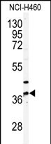 Rabbit Polyclonal Antibody to PANK3 (N-term)