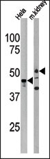 Rabbit Polyclonal Antibody to PSKH1 (N-term H70)