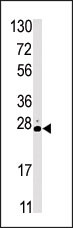 Rabbit Polyclonal Antibody to STK19