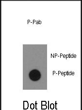 Rabbit Polyclonal Antibody to Phospho-ABL1(Y134)