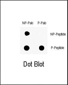 Rabbit Polyclonal Antibody to Phospho-ABL1(Y251)