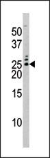 Rabbit Polyclonal Antibody to Phospho-Bad(S75)