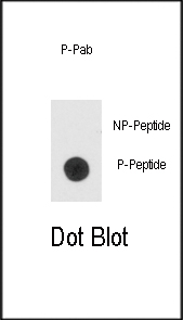 Rabbit Polyclonal Antibody to Phospho-Bad(S99)