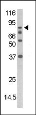 Rabbit Polyclonal Antibody to Phospho-DAXX(S213)