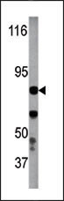 Rabbit Polyclonal Antibody to Phospho-IKKb(Y199)