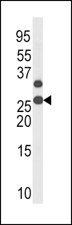 Rabbit Polyclonal Antibody to Phospho-p27Kip1(T187)