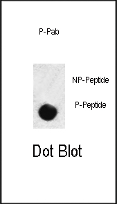 Rabbit Polyclonal Antibody to Phospho-SMAD3(S208)