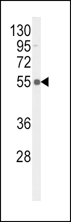 Rabbit Polyclonal Antibody to Phospho-TNFR(S274)