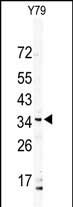 Rabbit Polyclonal Antibody to DSCR3 (N-term)