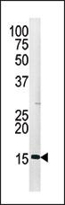 Rabbit Polyclonal Antibody to Phospho-H3(S28)