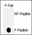 Rabbit Polyclonal Antibody to Phospho-p53(T18)